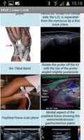 MSK ultrasound Lower Limb 截圖 3