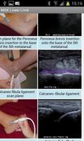 MSK ultrasound Lower Limb 截圖 1
