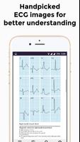 برنامه‌نما EKG Basics - Learning and inte عکس از صفحه