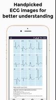 EKG Basics - Learning and inte screenshot 1