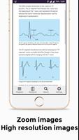 برنامه‌نما EKG Basics - Learning and inte عکس از صفحه
