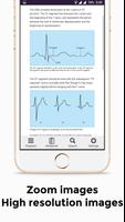 EKG Basics - Learning and inte screenshot 2