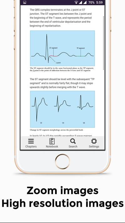 EKG Basics - Learning and interpretation made easy screenshot 2