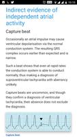 ECG Basics - Learning and inte screenshot 2