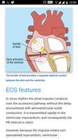ECG Basics - Full تصوير الشاشة 1
