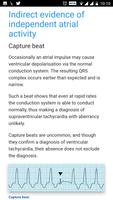 ECG Basics - Full تصوير الشاشة 2