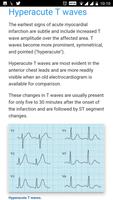 ECG Basics - Full 스크린샷 3