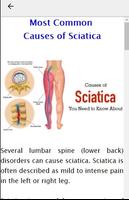 Sciatica Treatment capture d'écran 3