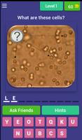 Urinalysis Quiz โปสเตอร์