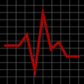 Vibration Meter