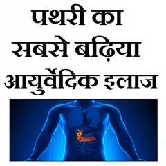 पथरी का सबसे बढ़िया घरेलू इलाज
