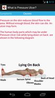 Pressure Ulcer تصوير الشاشة 3
