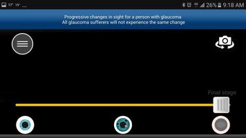 برنامه‌نما Glaucoma App عکس از صفحه