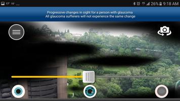Glaucoma App syot layar 2
