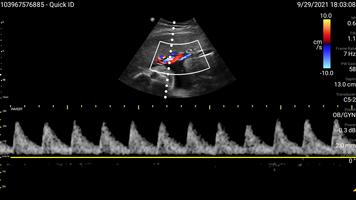 Philips Lumify Ultrasound App syot layar 2