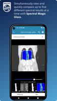 Philips CT Learning syot layar 3