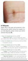 Model Dermatol – Skin Disease screenshot 3