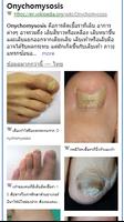 Model Dermatol – โรคผิวหนัง ภาพหน้าจอ 3