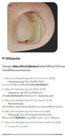 Model Dermatol – โรคผิวหนัง ภาพหน้าจอ 2