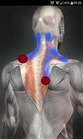 Trigger Points poster