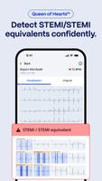 PMcardio स्क्रीनशॉट 2