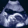 Pregnancy Baby & Baby Kick