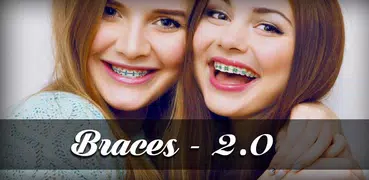 Braces 2.0