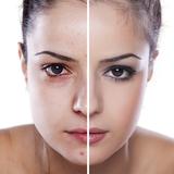 Before and After Video Maker آئیکن