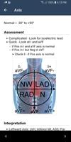 ECG Guide by QxMD imagem de tela 2