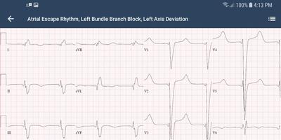 ECG Guide by QxMD ảnh chụp màn hình 3