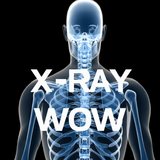 X-RAY WOW ikon