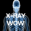 ”X-RAY WOW