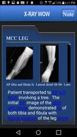 X-RAY WOW تصوير الشاشة 2