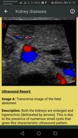 Ultrasound Guide capture d'écran 1