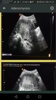 Ultrasound Guide ภาพหน้าจอ 2