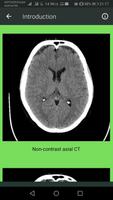 Brain CT Scan Interpretation capture d'écran 3