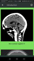 Brain CT Scan Interpretation capture d'écran 2