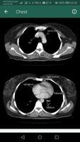 برنامه‌نما CT Scan Anatomy عکس از صفحه