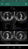 CT Scan Anatomy capture d'écran 3