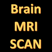 MRI Scan View Anatomy of Brain