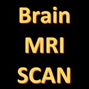 MRI Scan View Anatomy of Brain APK
