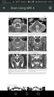 MRI Scan View Anatomy Affiche
