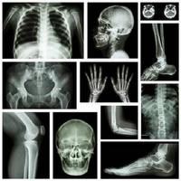 musculoskeletal x-ray interpretation captura de pantalla 1
