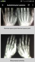 musculoskeletal x-ray interpretation capture d'écran 2