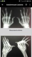 musculoskeletal x-ray interpretation capture d'écran 3