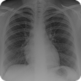 Radiology Tutor biểu tượng