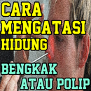 Ramuan Herbal Mengatasi Hidung Bengkak Atau Polip APK