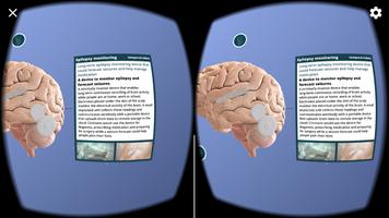 Wyss Center Neurotech Brain screenshot 1
