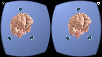 Wyss Center Neurotech Brain screenshot 2