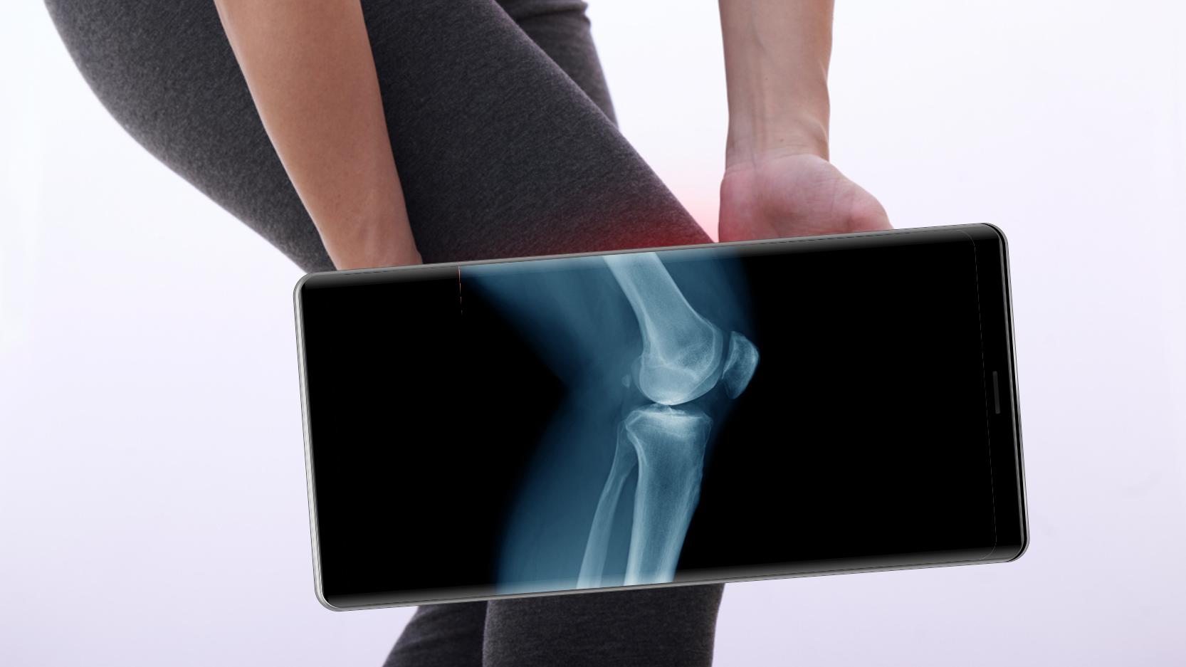 X ray перевод X ray перевод